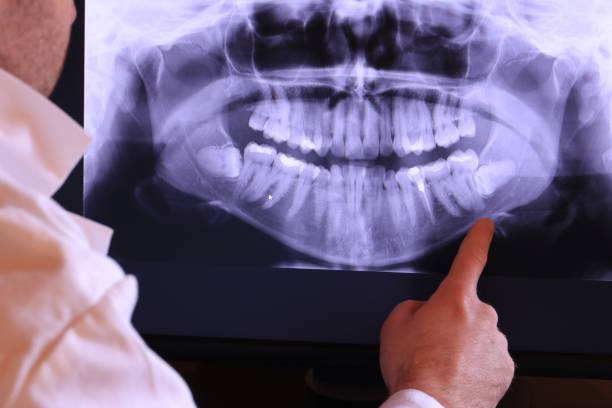 Best Weekend Emergency Dentist in Briar Chapel, NC