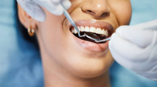 Best Emergency Root Canal Treatment in Briar Chapel, NC